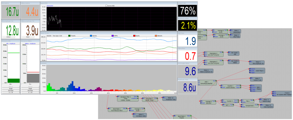 Przykładowy protokół treningowy neurofeedback