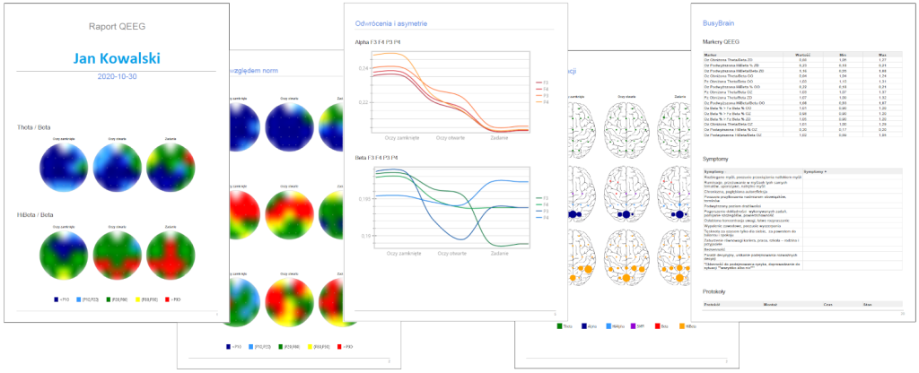Przykładowy raport QEEG z gabinetu Incepcja Neurofeedback